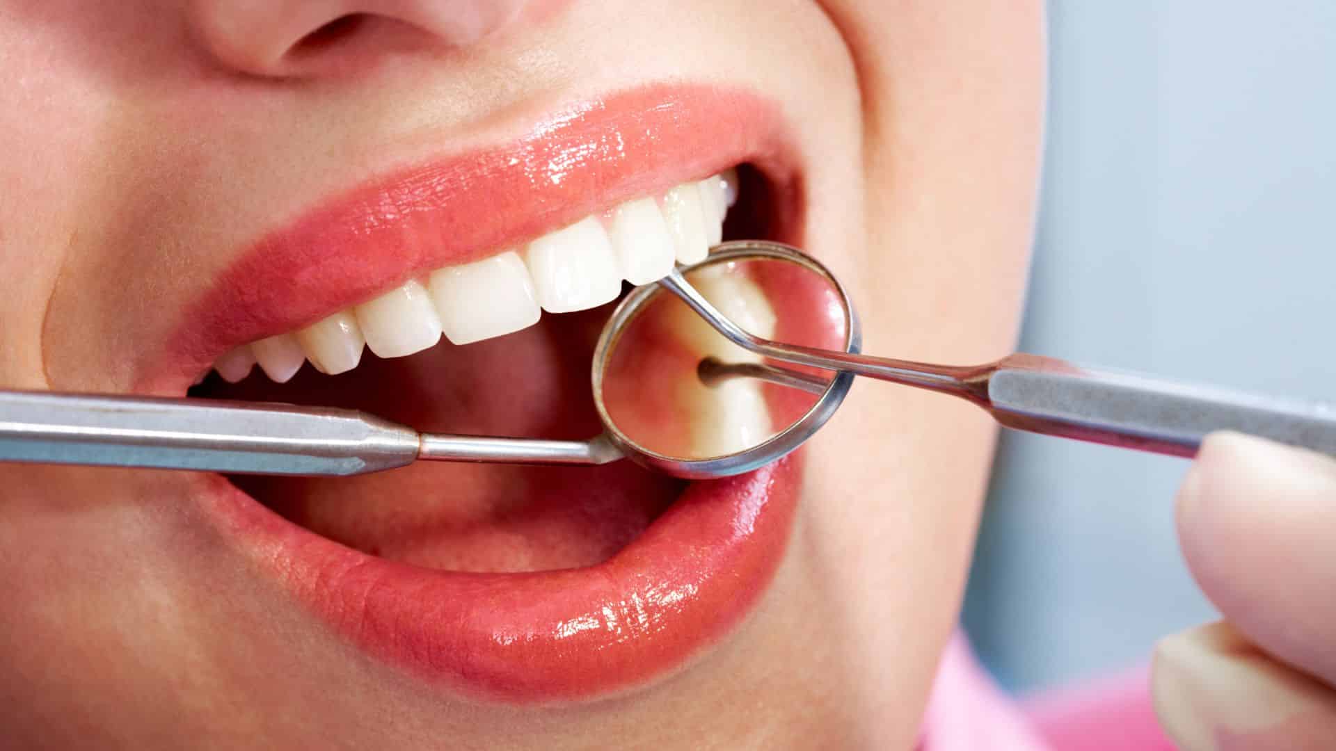 Dental