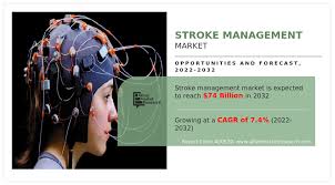 Stroke Management